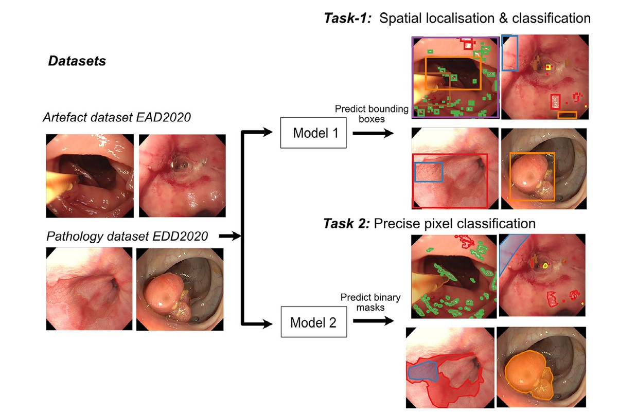 yayınlar-Deep learning for detection and segmentation of artefact and disease instances in gastrointestinal endoscopy-1