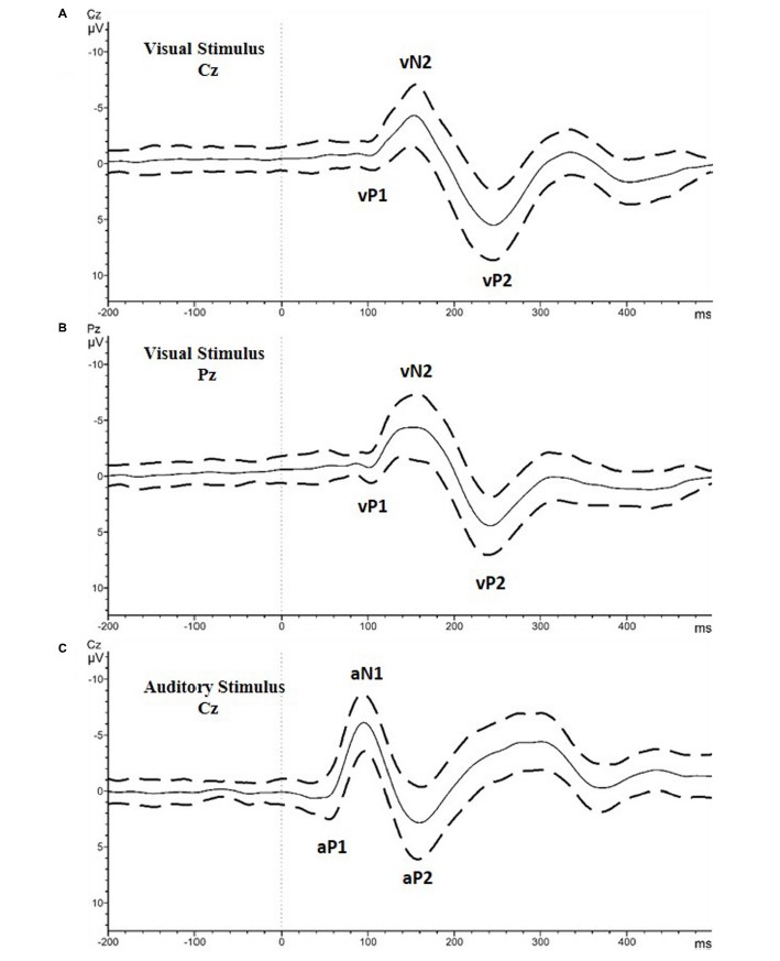 yayınlar-Auditory Processing Differences Correlate With Autistic Traits in Males-1