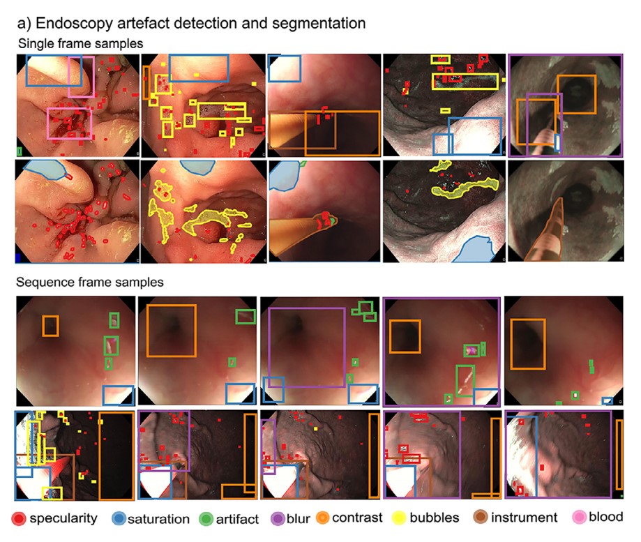 paper-Deep learning for detection and segmentation of artefact and disease instances in gastrointestinal endoscopy-1