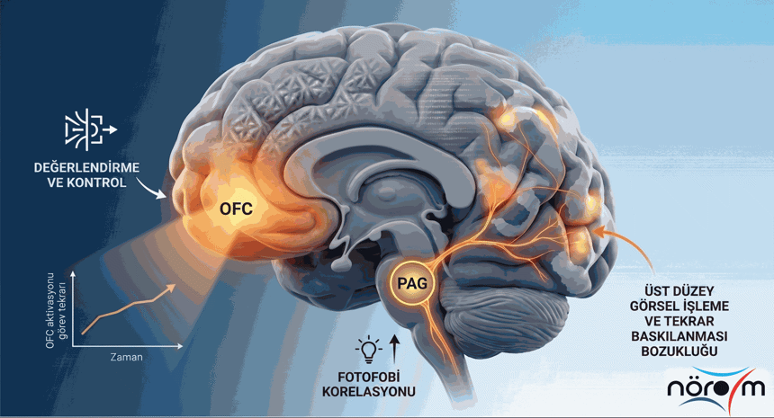 Zihinsel Yorgunluk ve Migren: Görsel İşleme Süreçlerindeki Değişim