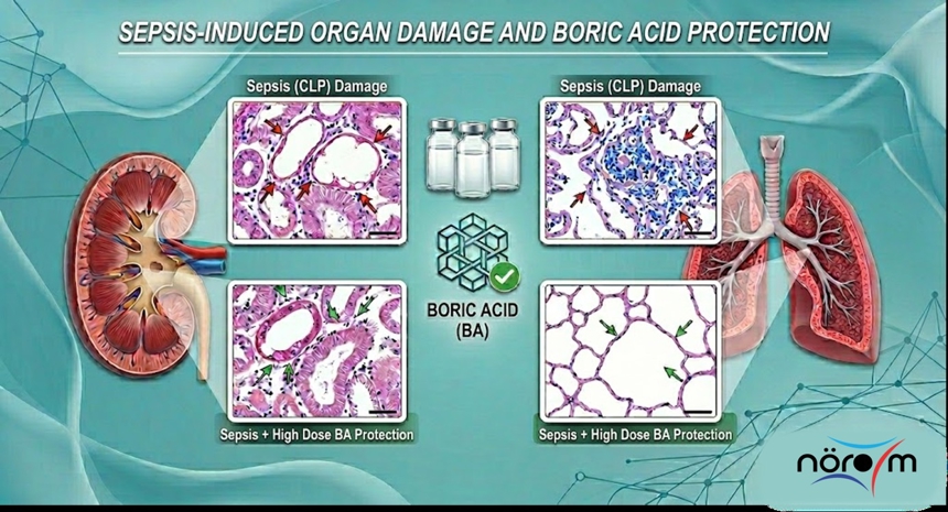 NÖROM Research: Protective Effects of Boric Acid on Sepsis-Induced Organ Damage