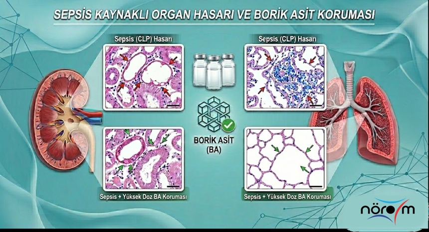 NÖROM Araştırması: Borik Asidin Sepsis Kaynaklı Organ Hasarı Üzerindeki Koruyucu Etkileri