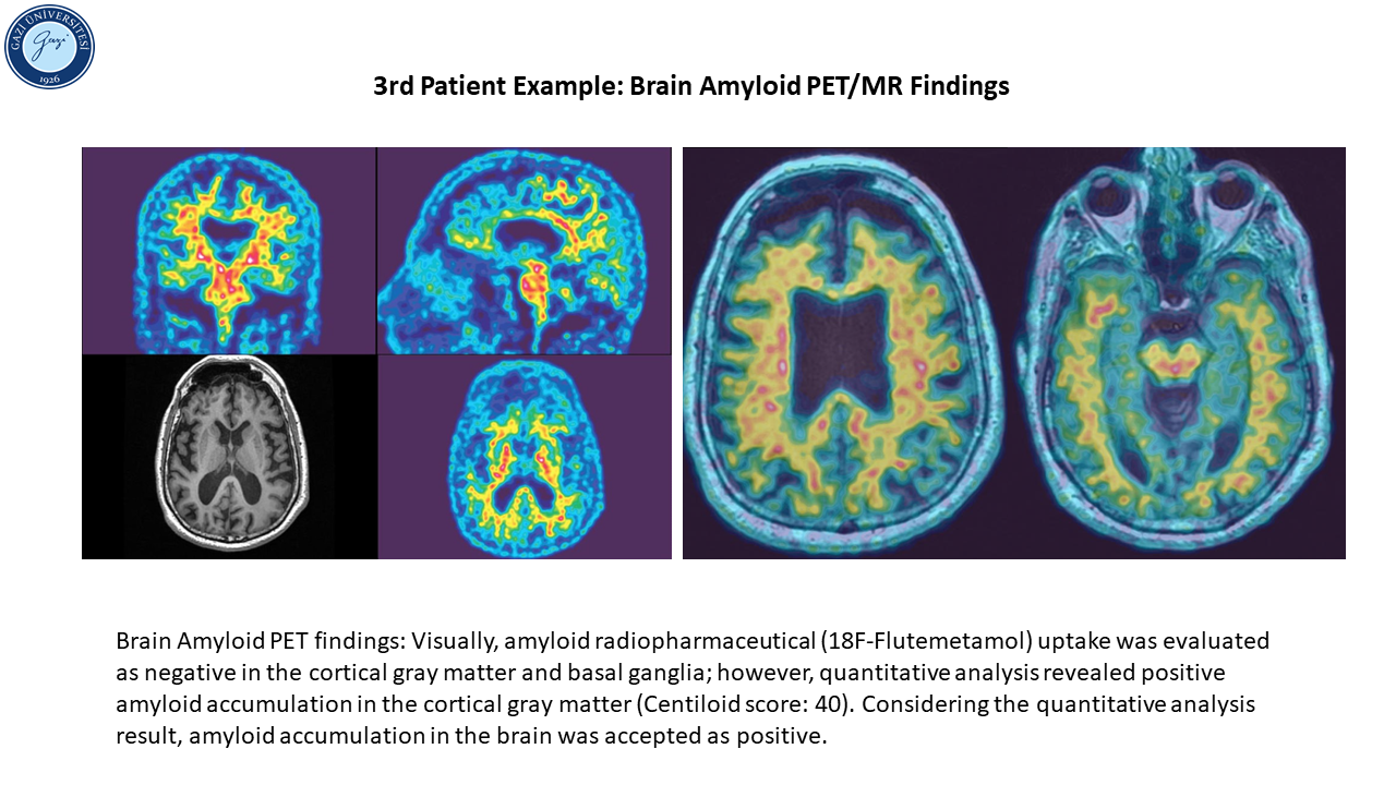 Patient example_3_2-1