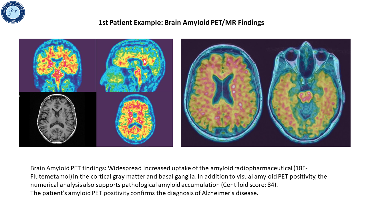 Patient example_1_2-1