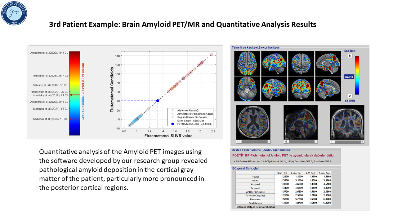 Patient example_3_3-1