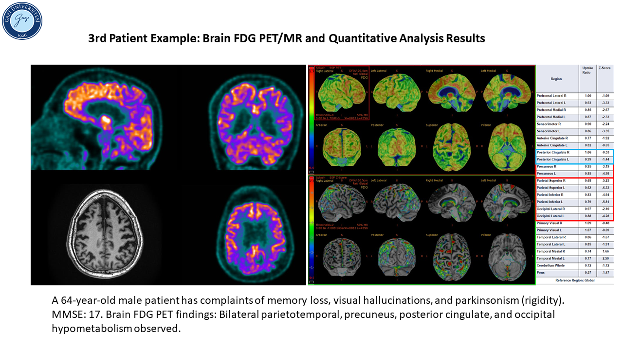 Patient example_3_1-1