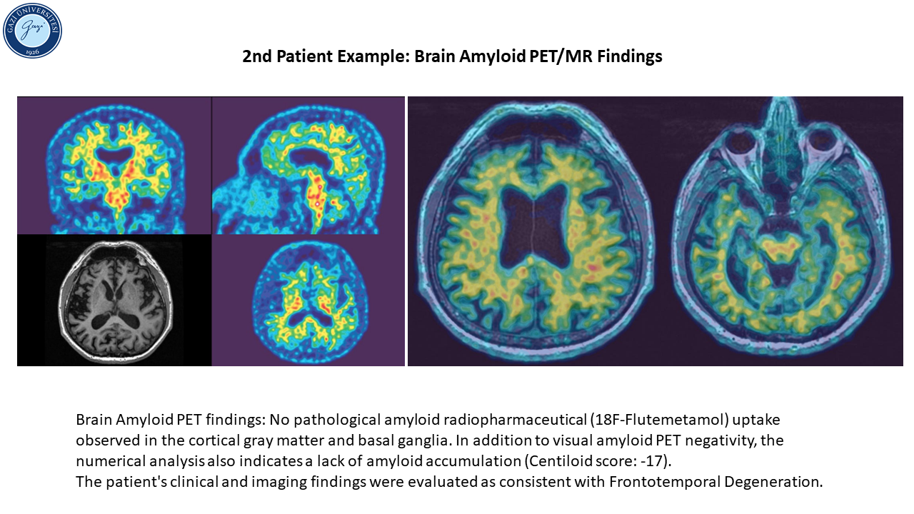 Patient example_2_2-1