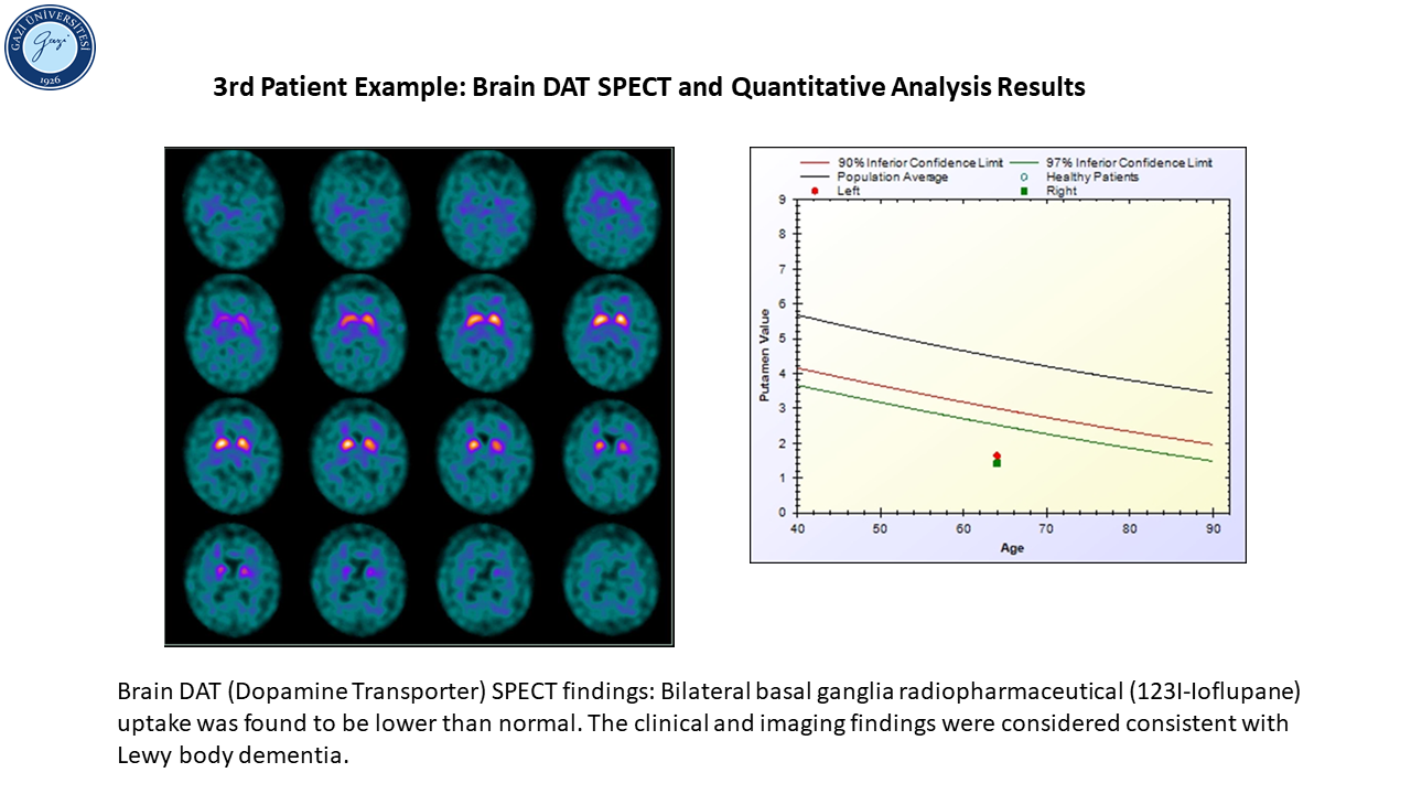 Patient example_3_4-1